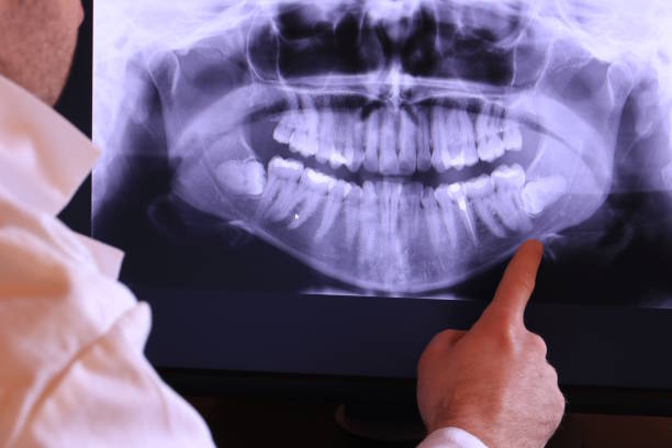 Best Emergency Dental Care for Trauma or Injury in St Joseph, MN