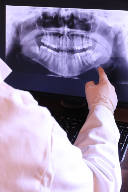 Best Emergency Dental Surgery in St Joseph, MN